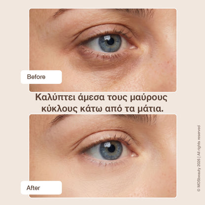 CC κονσίλερ για τους μαύρους κύκλους MOS